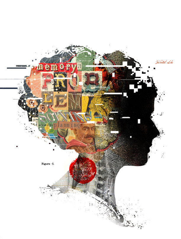 WomanStrokeAftermath